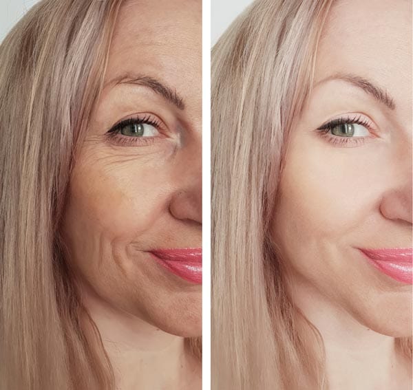 Challenges in Editing Dark Skin Tones