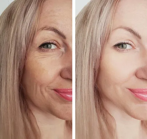 Correct skin tones and other colors with the Camera Raw Filter