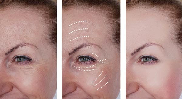 Enhancing Highlights and Shadows