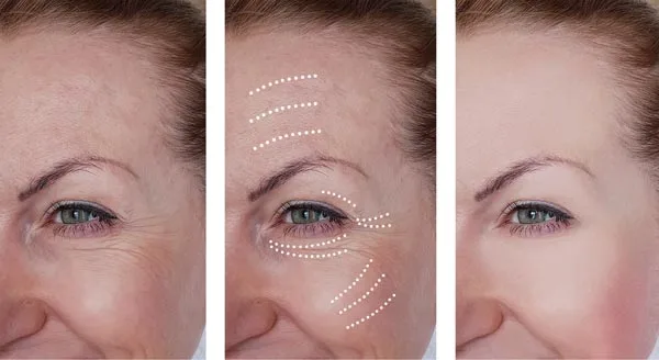 Enhancing Highlights and Shadows