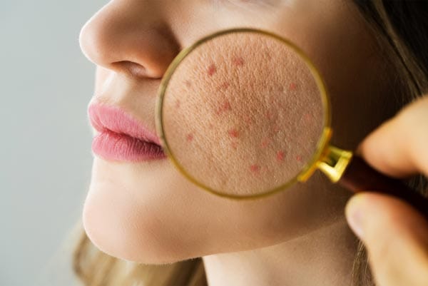 Preserving Skin Texture and Undertones